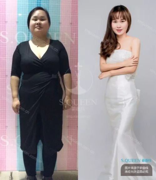 生育损害,生育后做哪些产后修复