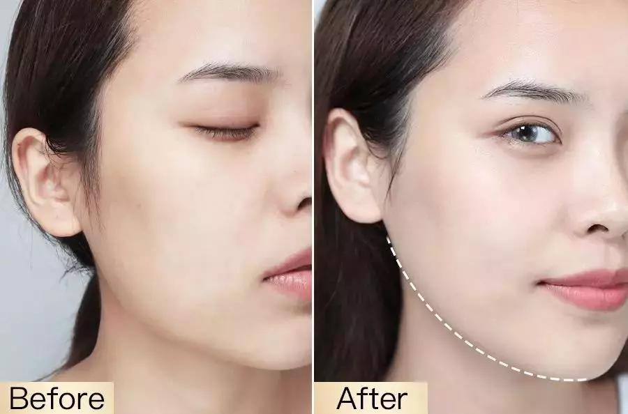 影后强势打Call！1片去浮肿、3周变紧致，大饼脸也有救了