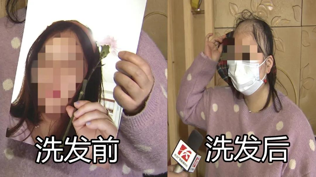 女子养发养到秃顶后续结果,女子美容院养发变秃头