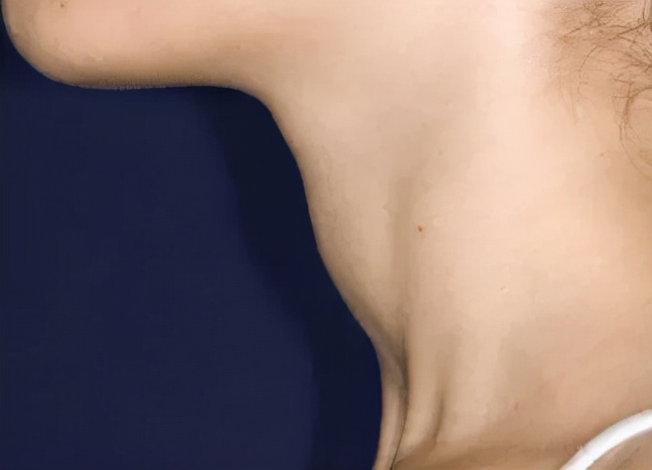 食堂阿姨手会抖是什么病,食堂阿姨手抖原来真是有原因的