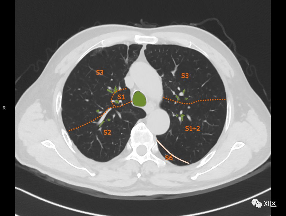 如此详细的肺部影像解剖，有点儿酷！