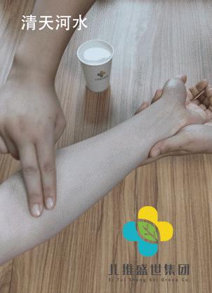 宝宝湿疹应该忌口什么,外阴湿疹好了以后还用忌口吗