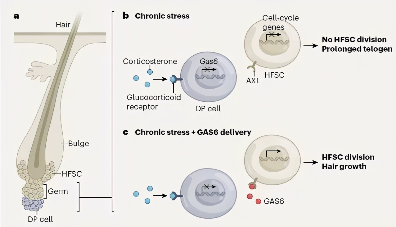 “压力秃”有可能逆转，英国《自然》杂志揭秘毛囊是怎样被压垮的