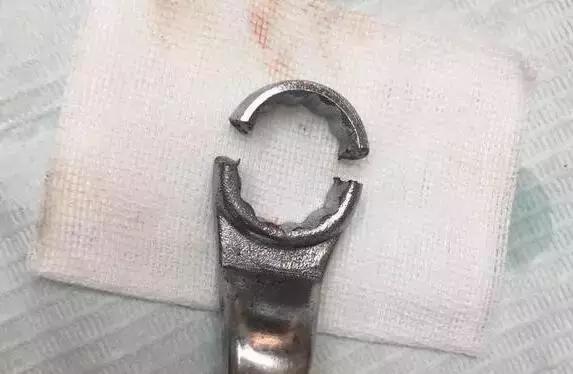 姑娘,我掏根管的时候,你舌头放尊重一点