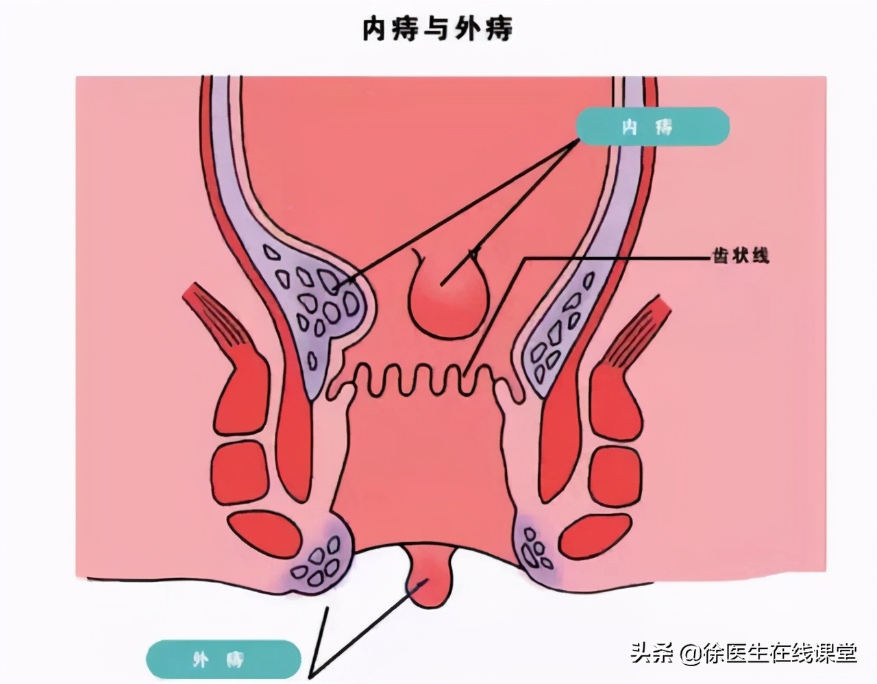 甲硝唑是便宜的和贵的有什么区别,甲硝唑便宜的和贵的有什么区别