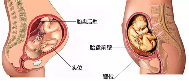 胎心监护时胎心率怎么断断续续的,胎心如何找