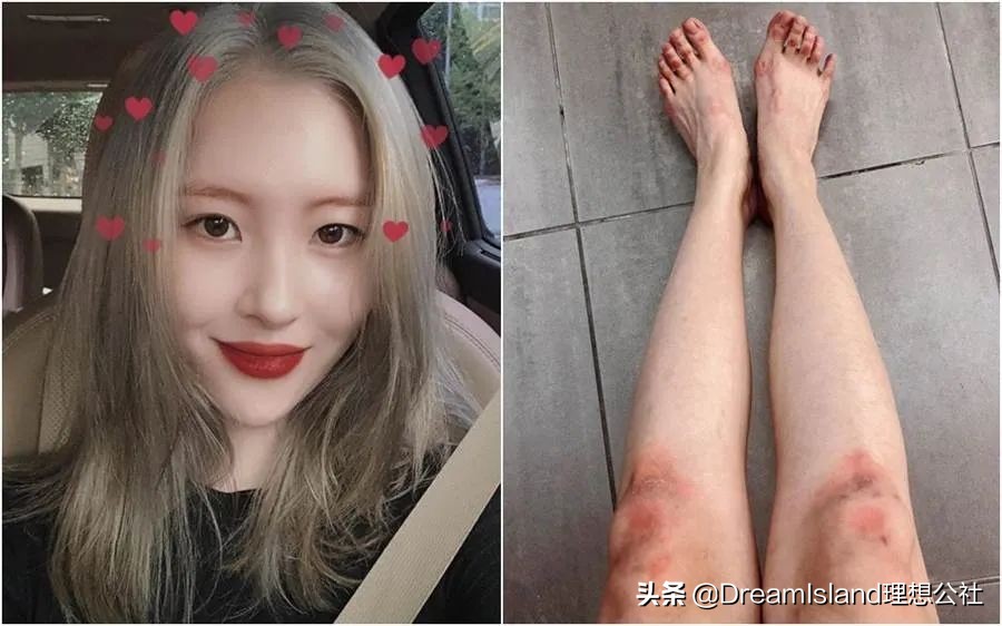 从过气女团到solo天后，宣美是如何在残酷的韩娱圈站稳的？