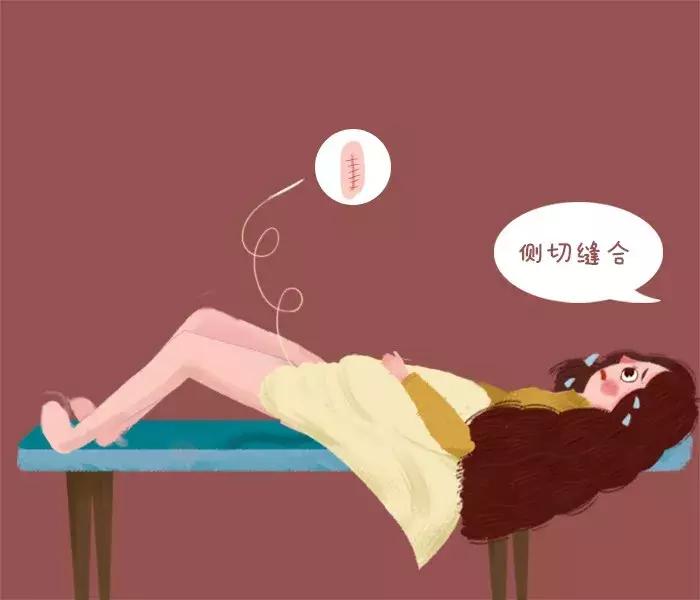 顺产一共要挨多少刀,顺产挨一刀还是侧切