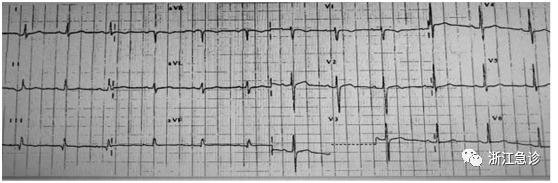 颈肩痛用针刺疗法效果好吗,颈肩腰腿疼儿童疾病