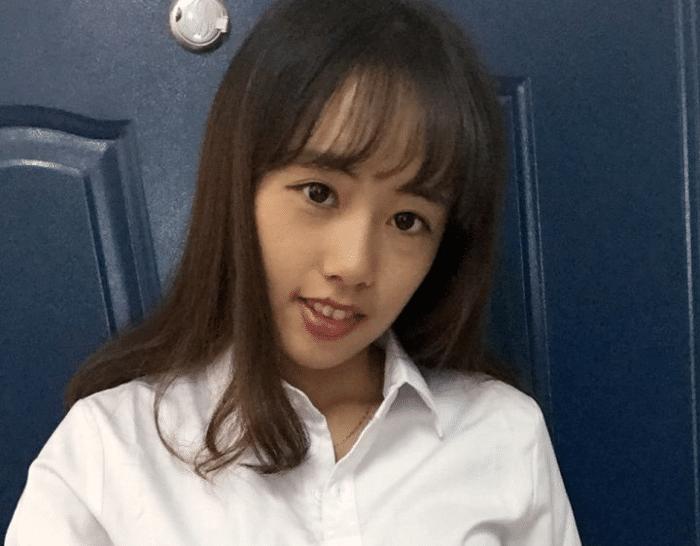 牙套隐形日记,牙套日记正颌