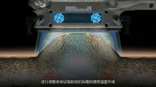 抽脂塑形央视新闻,央视提到减重代谢手术