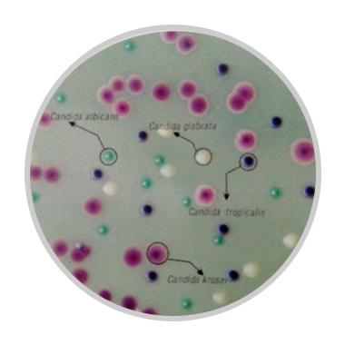 显色培养基教程,显色培养基用途