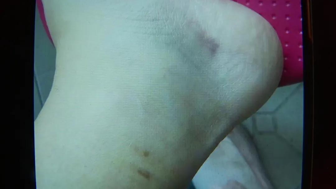 小区感应门夹伤谁负责,门禁伤到人怎么追究