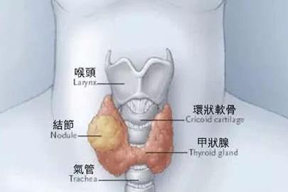 这个病女性比男性发病更可怕,年轻女性发病率较高的疾病有哪些