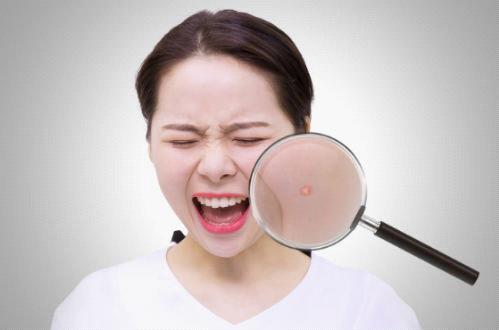 脸抹上护肤品有点刺痛是缺水吗,皮肤缺水涂护肤品有刺痛感