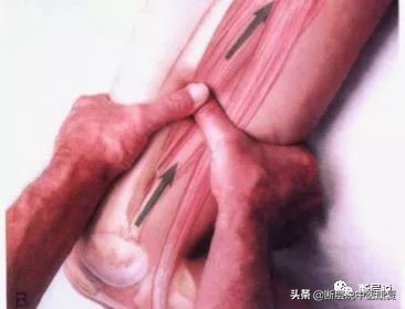 女性盆底健康问题,针刺要扎三阴交,手法要选内收肌