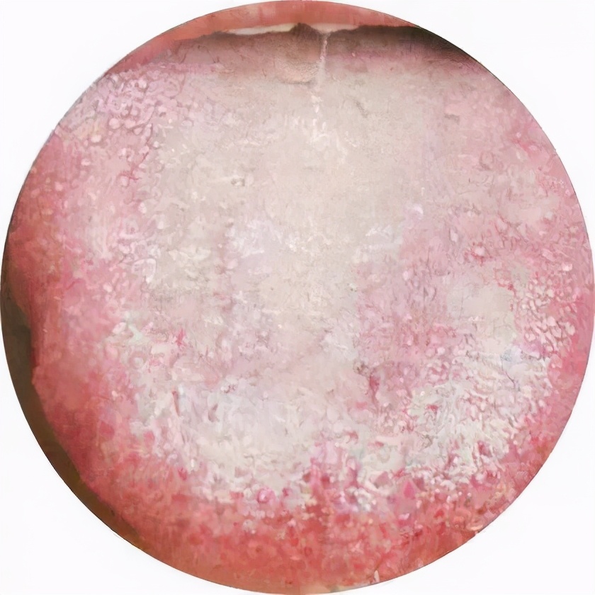 养肾等于续命？那如果是肾虚该怎么办？试试省中医的这个方法