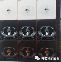 怎么应用统计学做调查,统计学方法可以解决的主要问题