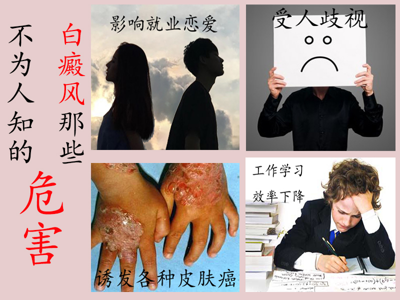 什么原因会导致婴儿得白癜风,孩子出生就有白癜风原因