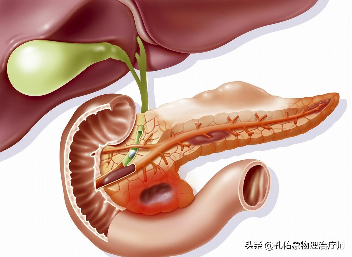肩膀疼是肩周炎吗还是其他原因,肩周炎肩膀疼痛怎么锻炼