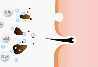 长黑头VS不长黑头差距这么大?精致女孩如何绕过黑头这道坎?