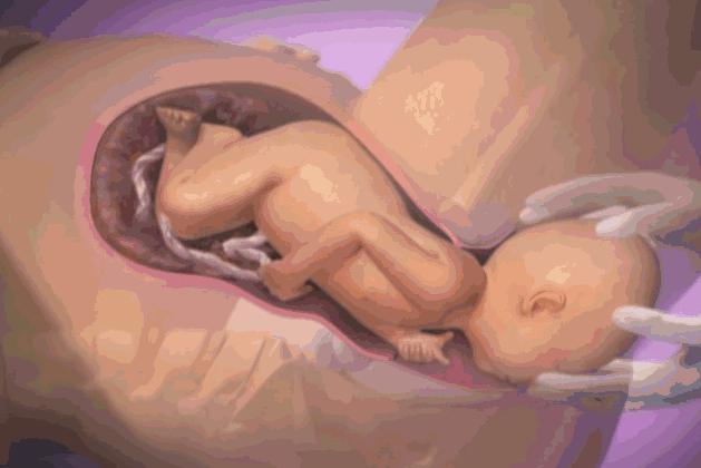 顺产生孩子的时候有多痛,女性生孩子到底有多痛分娩体验