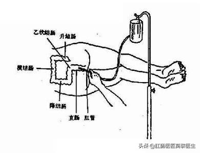 痔疮术后用力大便又裂开了怎么办,痔疮手术第二天屁放不出来