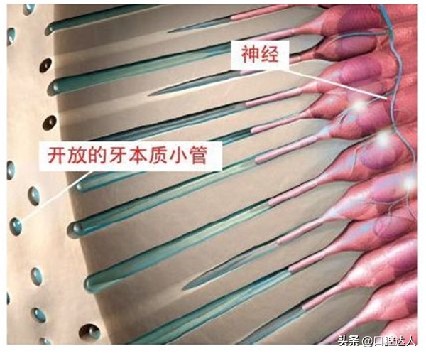 补过的牙几年后突然又疼了怎么治,补了几年的牙突然疼痛要如何解决