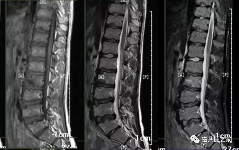 腰椎有哪些病变,腰椎病变有几种