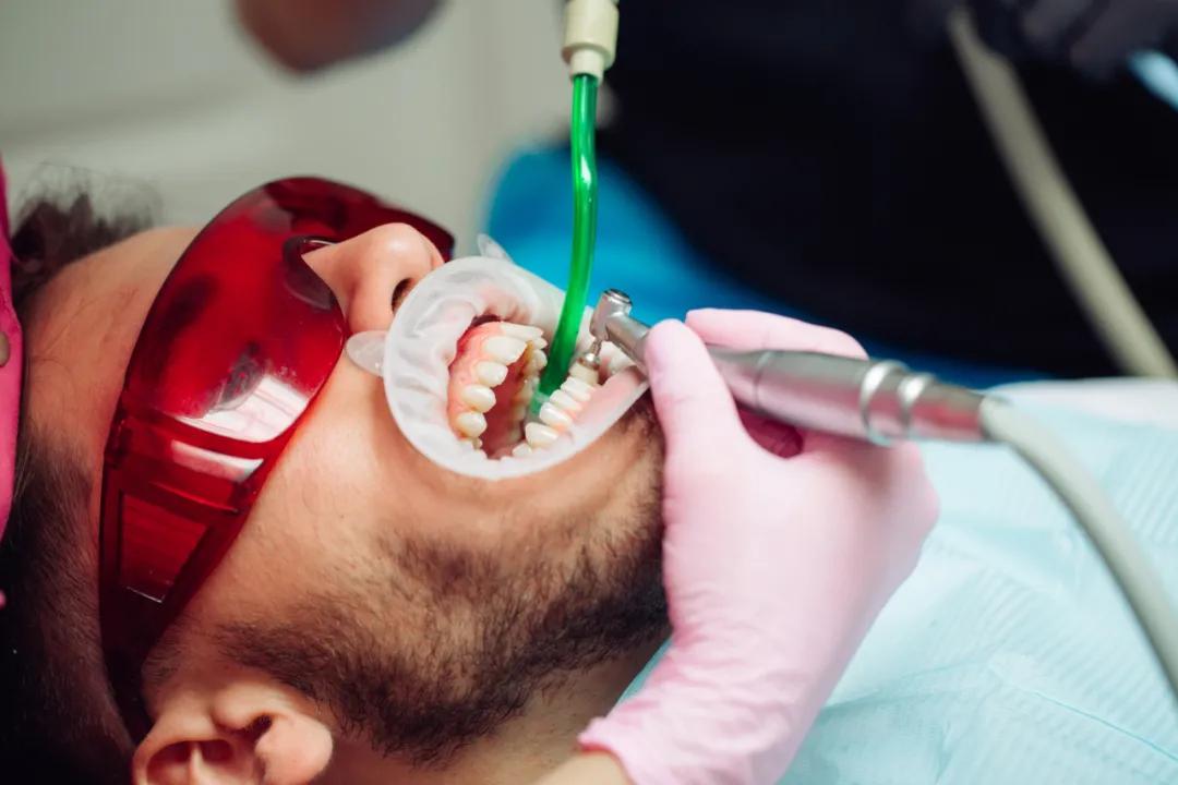 草莓籽在牙缝里为什么会发芽,草莓籽卡牙缝