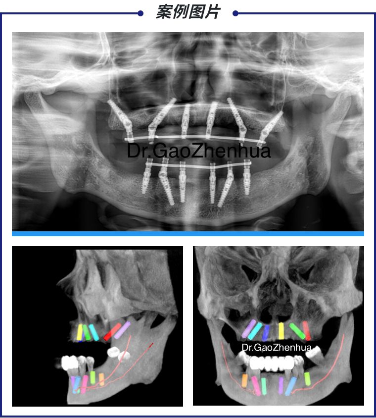 现在牙医技术到了什么水平了,牙医到底多厉害