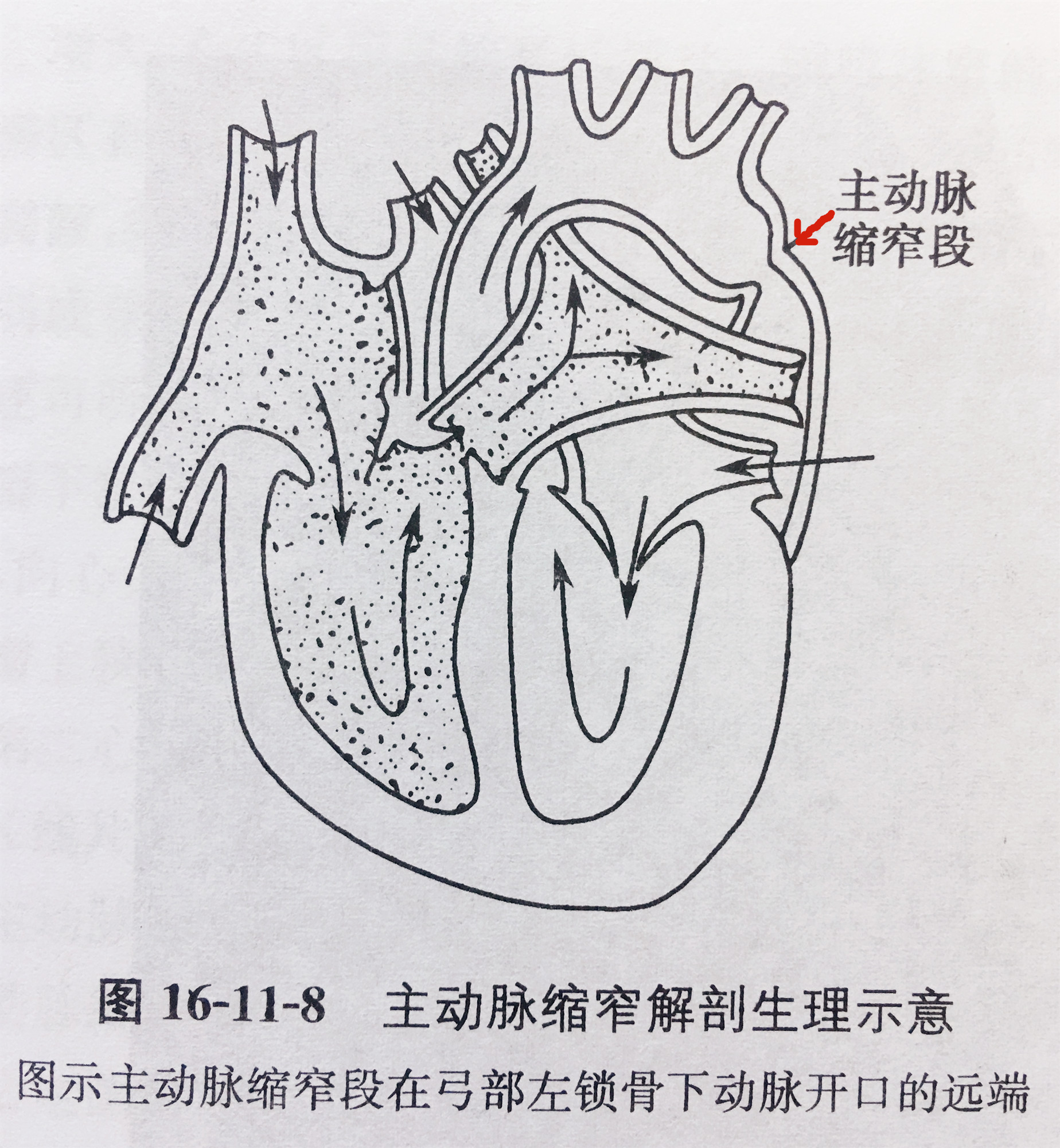 新发现的继发性高血压,错过也许就是一生原版