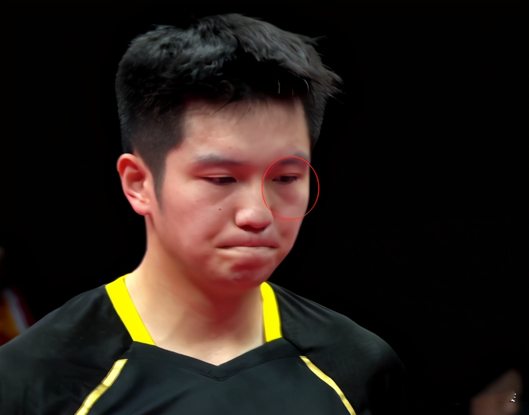 樊振东对战巴西,樊振东被球击中眼睛