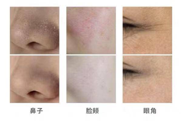 1万多的软水机和几千的软水机,软水机便宜的和贵的差别在哪