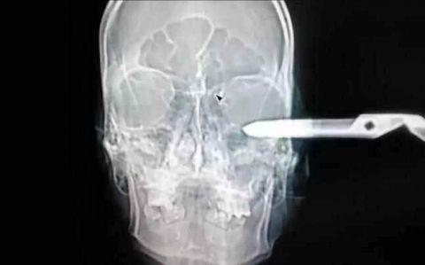 不作死就不会死看看你中了几条,不作死就不会死让人看的头皮发麻