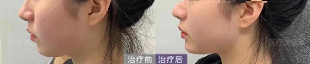 拥有一张好看的脸,如何拥有好看的脸型