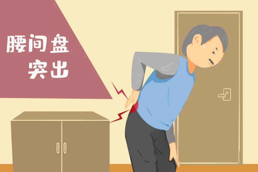 硬床好还是软包床好,腰椎间盘突出睡软床还是硬床垫好