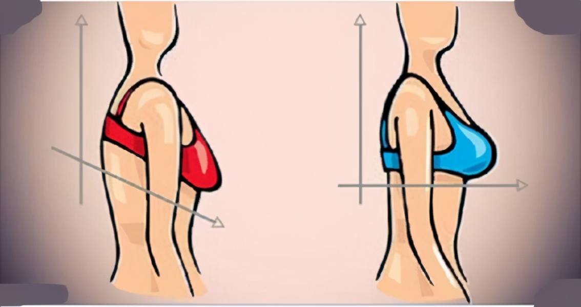 产后胸部严重松软下垂,产后喂母乳怎么防止胸部下垂