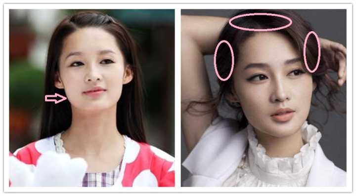 如何改善咬肌鹅蛋脸,咬肌变大脸发腮怎么改善