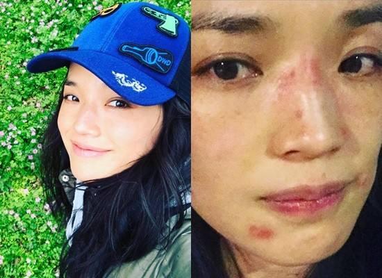 舒淇皮肤过敏,舒淇皮肤过敏化妆