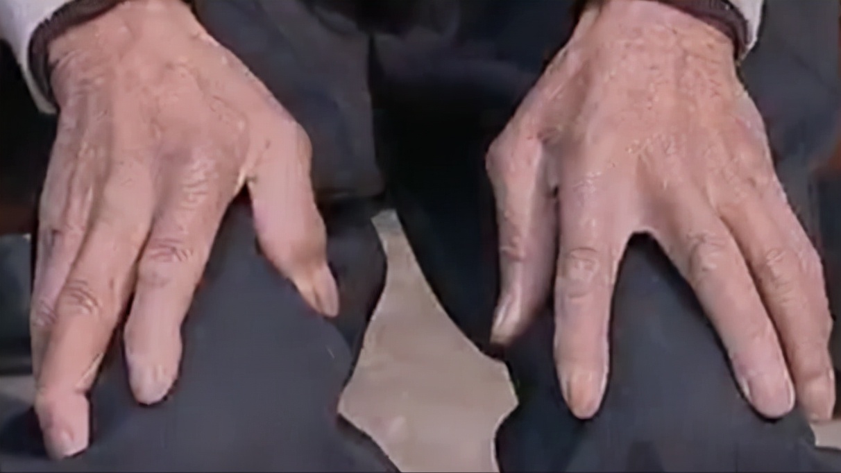 老人突然人体自燃烧成灰,老人自燃真实视频