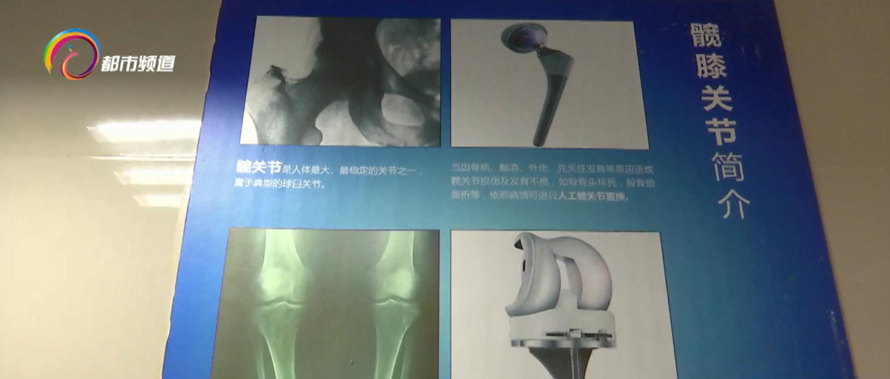 冬天不穿秋裤容易得膝盖关节炎,不穿秋裤真会冻出关节炎风湿病吗