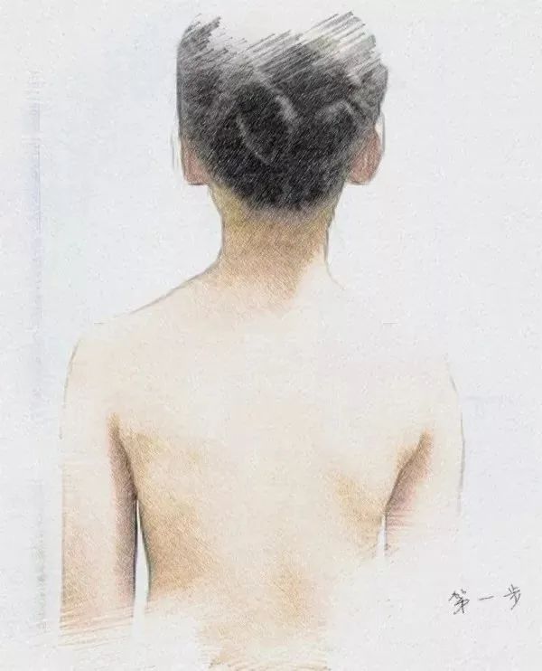 脊柱侧弯专科门诊,脊柱侧弯挂脊柱外科