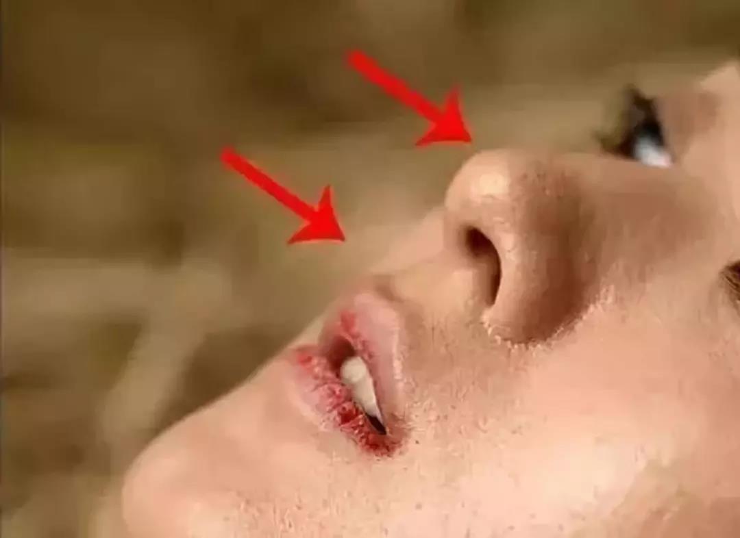 一秒去黑头去粉刺,一步就能搞定的黑头