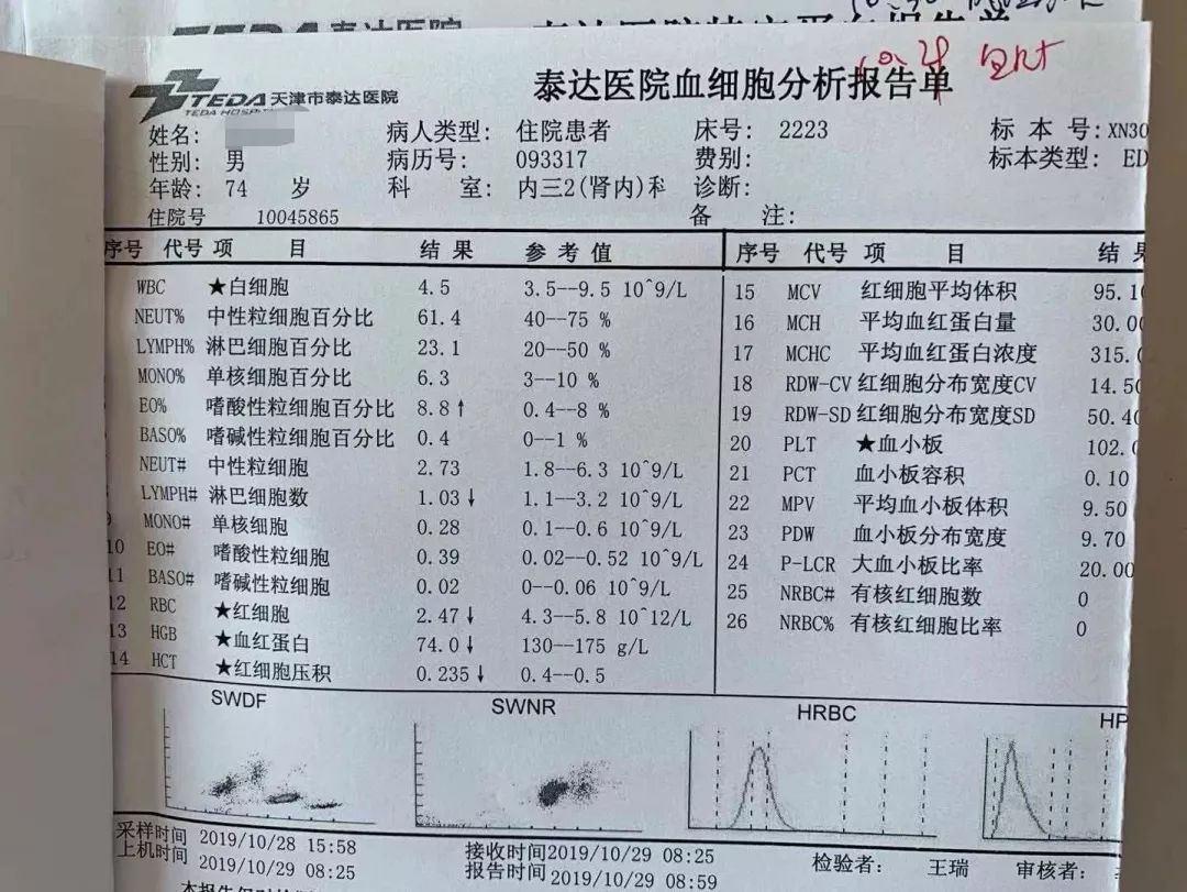 从正常发展到尿毒症要多久,开始肾病到死亡有多长时间