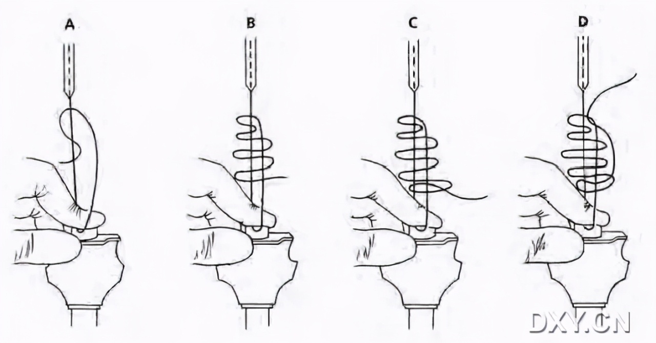 实用大全：腹腔镜下缝合与打结
