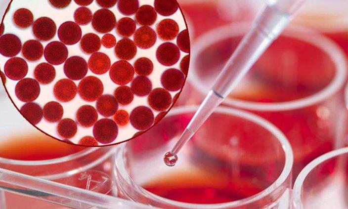 科颜氏金盏花水适合干性皮肤吗 (科颜氏的金盏花水适合什么肤质)