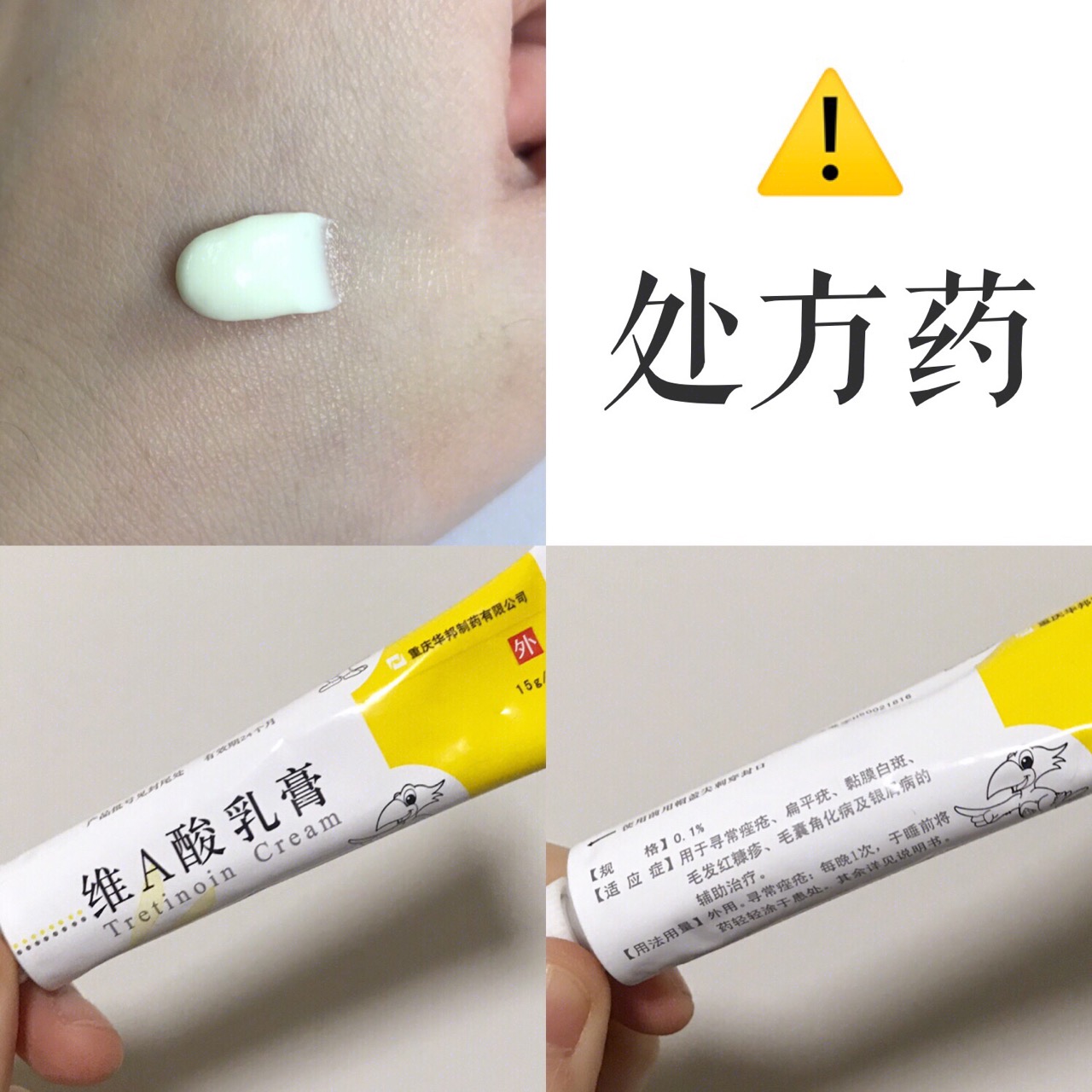 网上卖的十大祛痘药,女孩子必用的祛痘神器