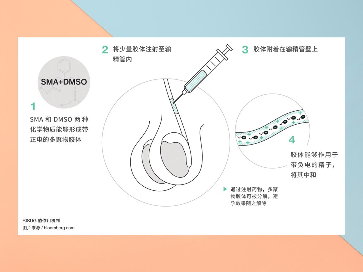 首款注射式男性避孕药通过临床试验,男性避孕时代近在眼前了?