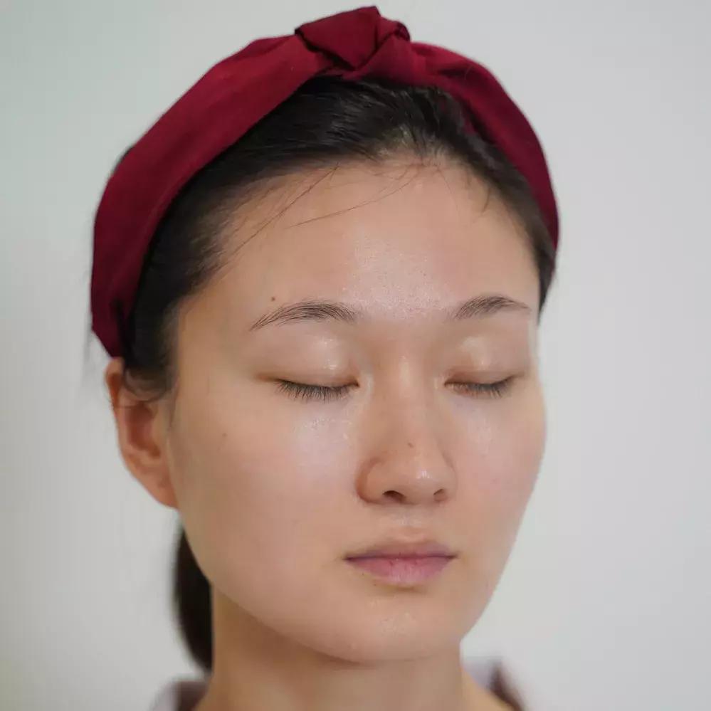 凹面型侧脸怎么改善,凹面型侧脸是怎么造成的